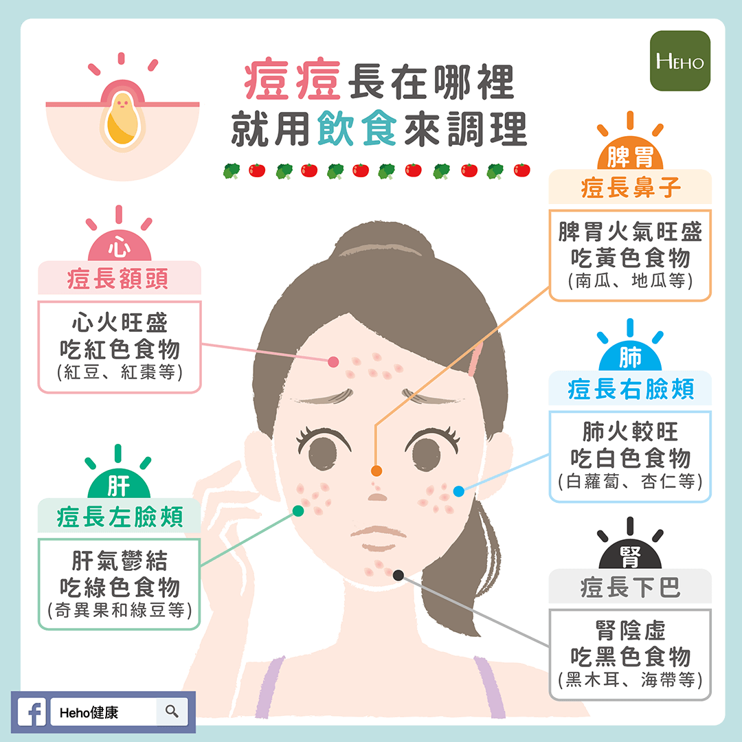 貼藥布有助痘痘消炎 消滅痘痘要從飲食做起 Heho生活